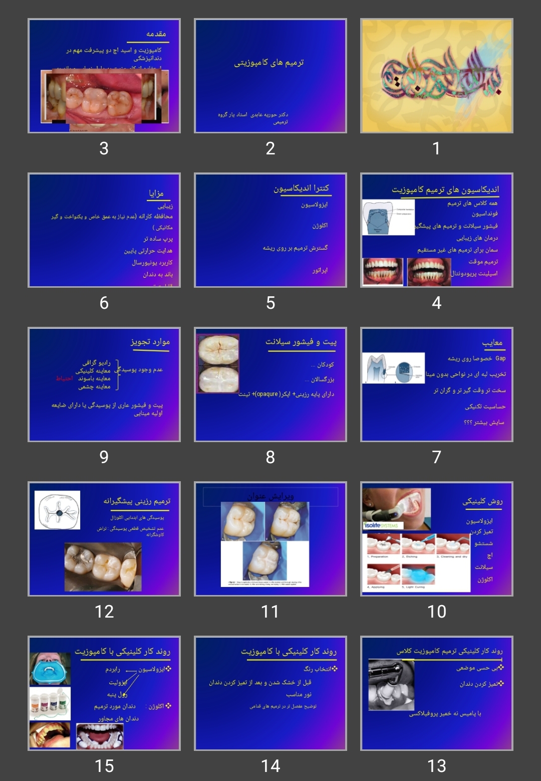 پاورپوینت ترمیم های کامپوزیتی