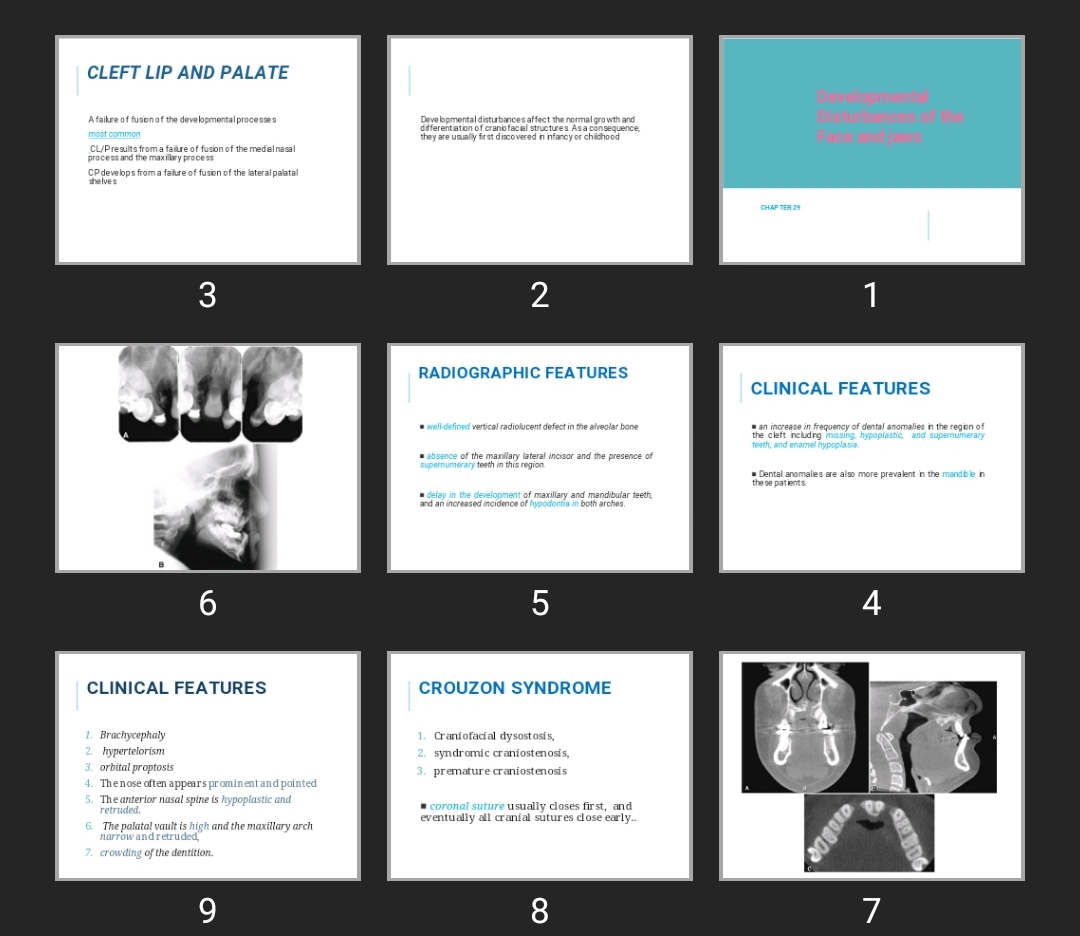 پاورپوینت Developmental Disturbances of the Face and jaws