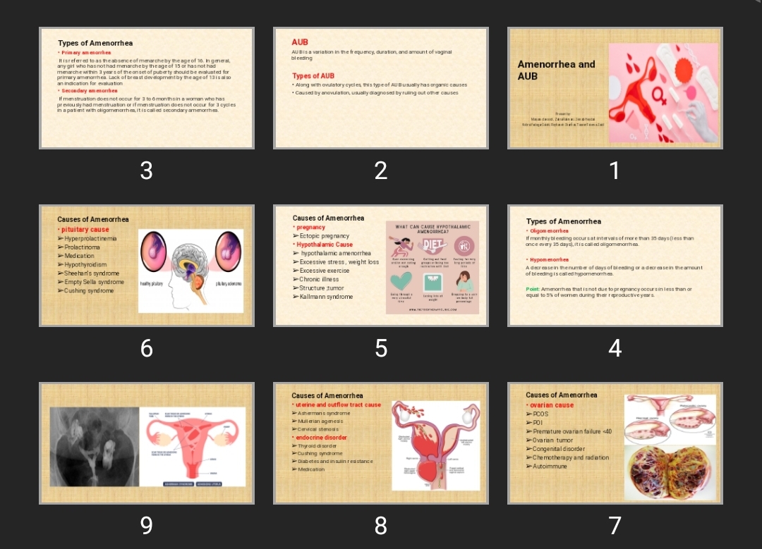 پاورپوینت Amenorrhea and AUB