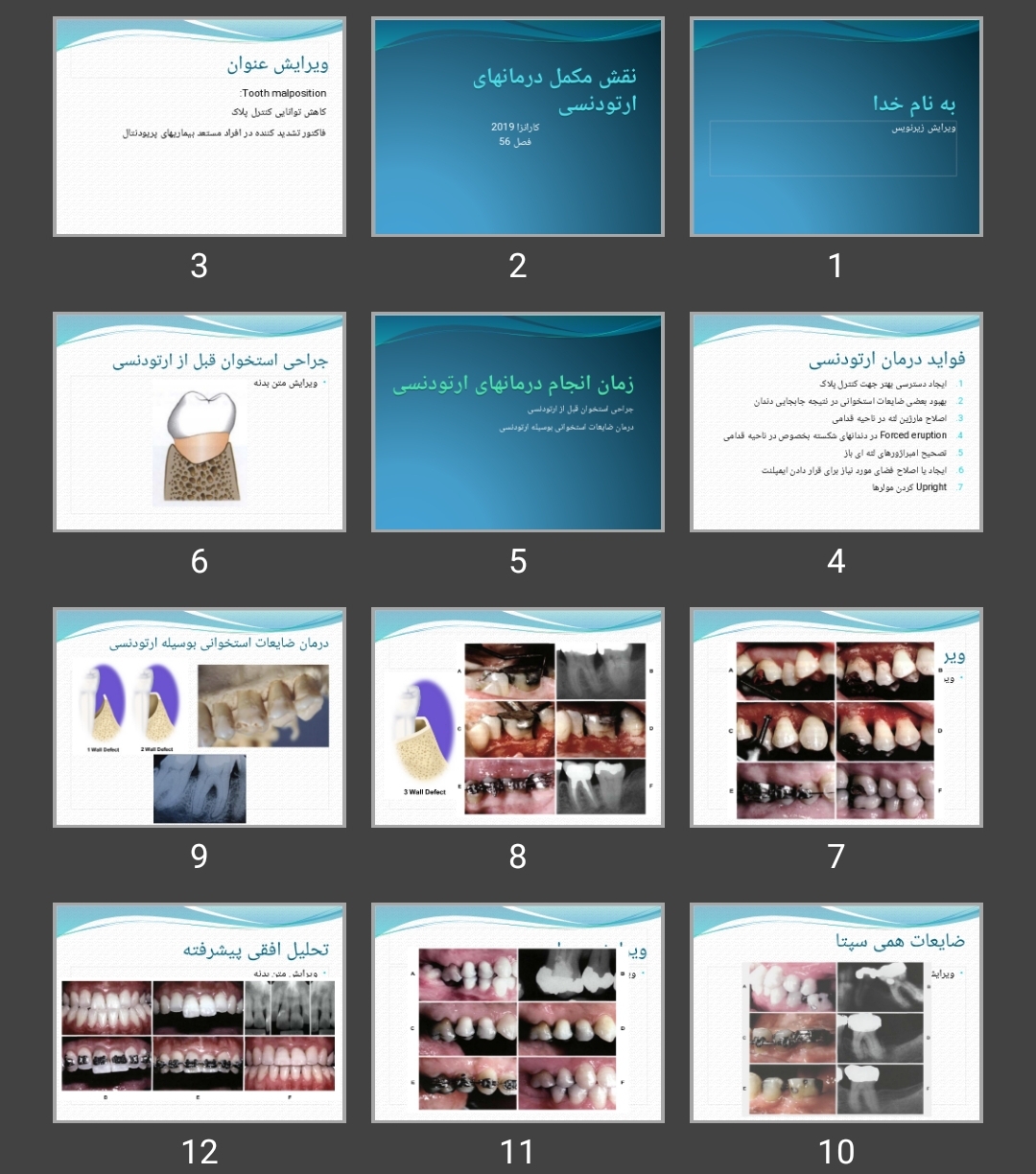 پاورپوینت نقش مکمل درمان های ارتودنسی