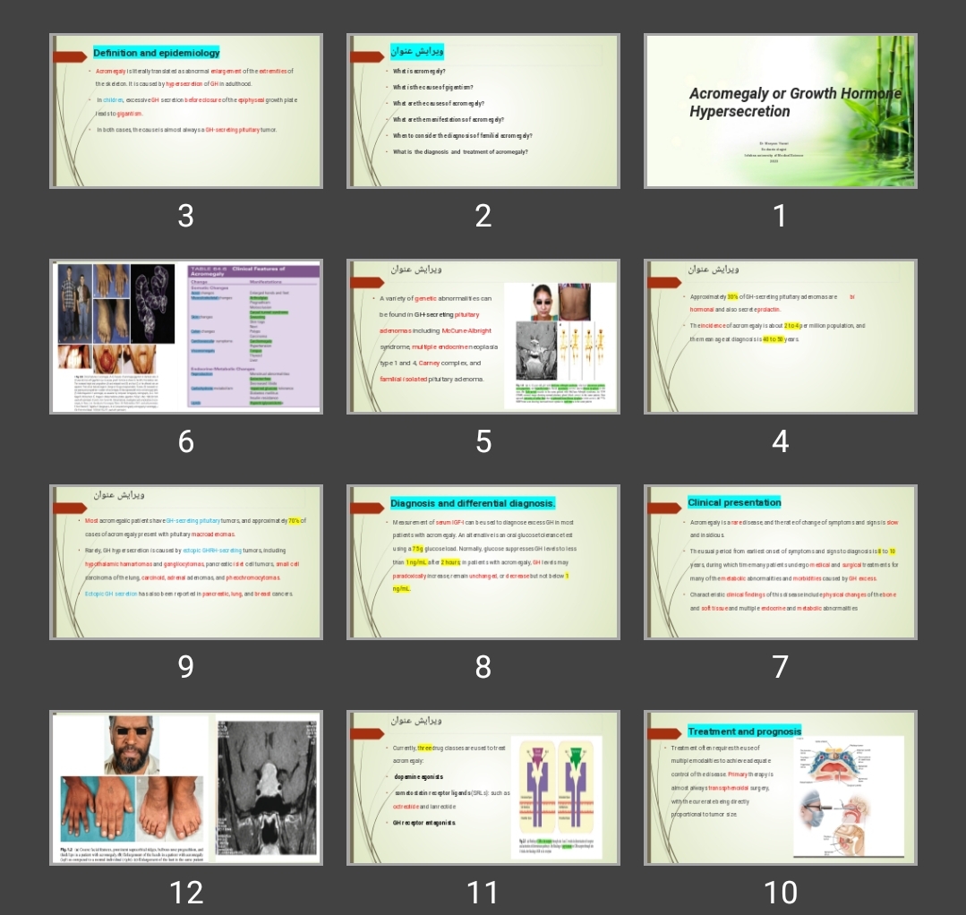 پاورپوینت Acromegaly or Growth Hormone Hypersecretion