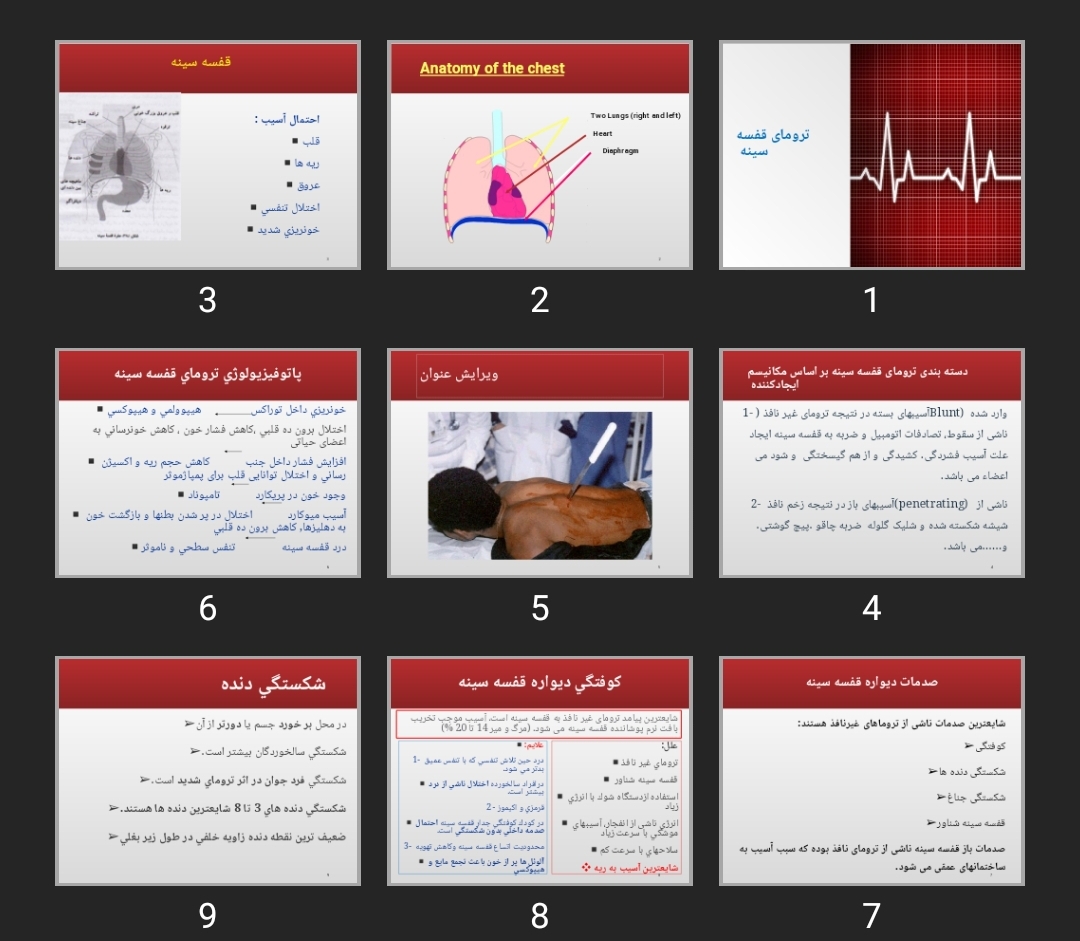 پاورپوینت ترومای قفسه سینه