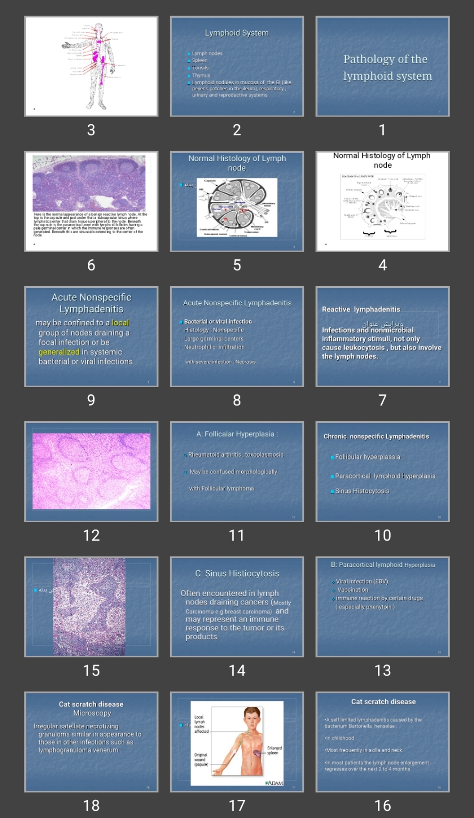 پاورپوینت Pathology of the lymphoid system