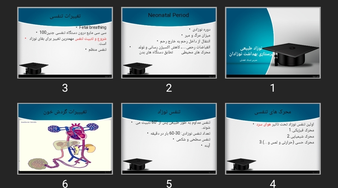 پاورپوینت نوزاد طبیعی