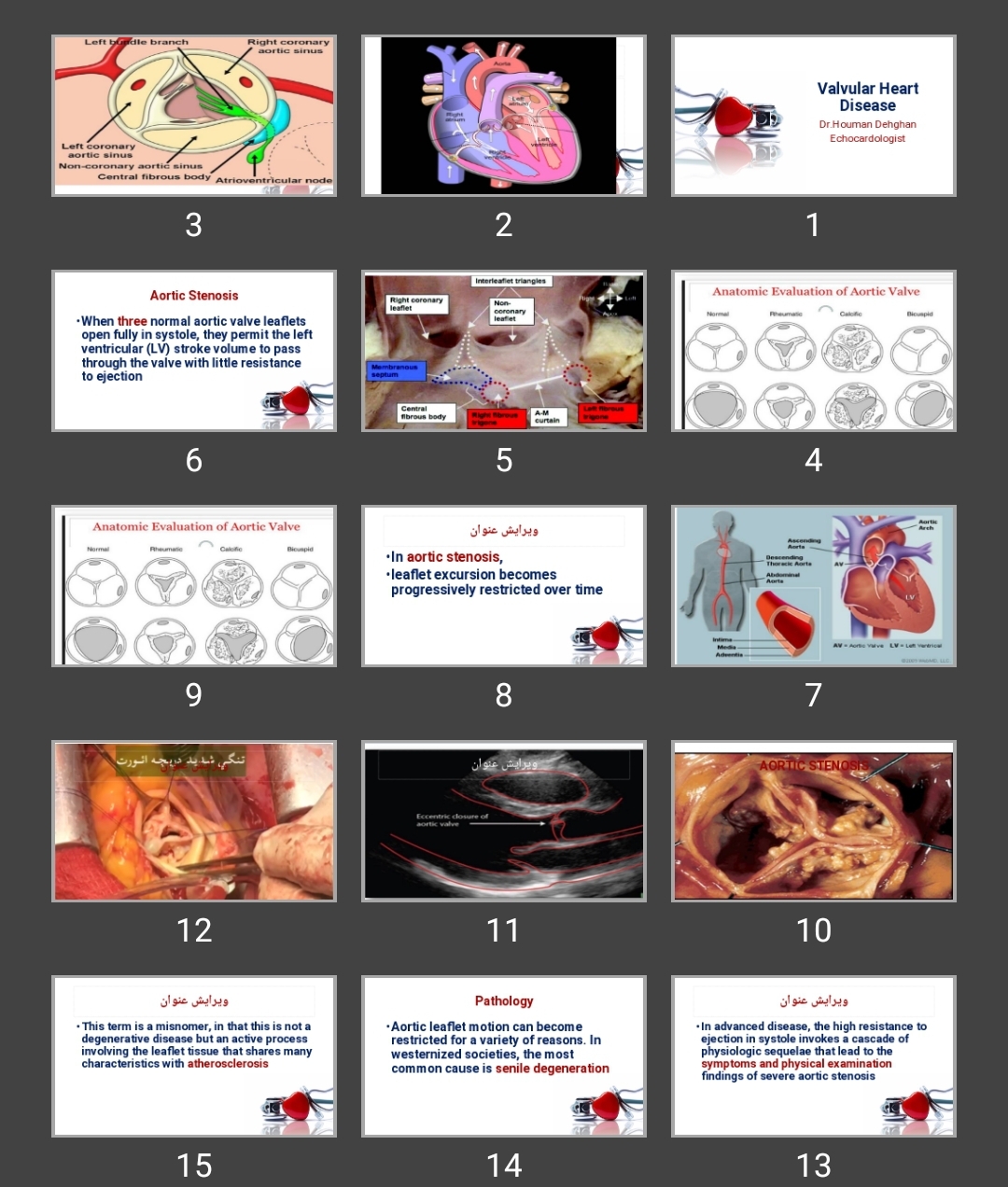 پاورپوینت اندوکاردیت Valvular Heart Disease