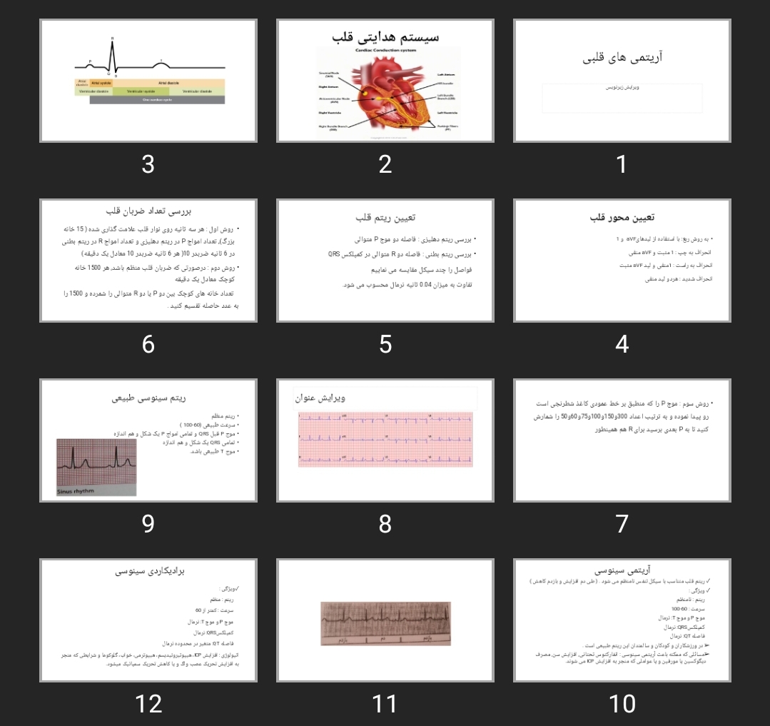 پاورپوینت آریتمی های قلبی