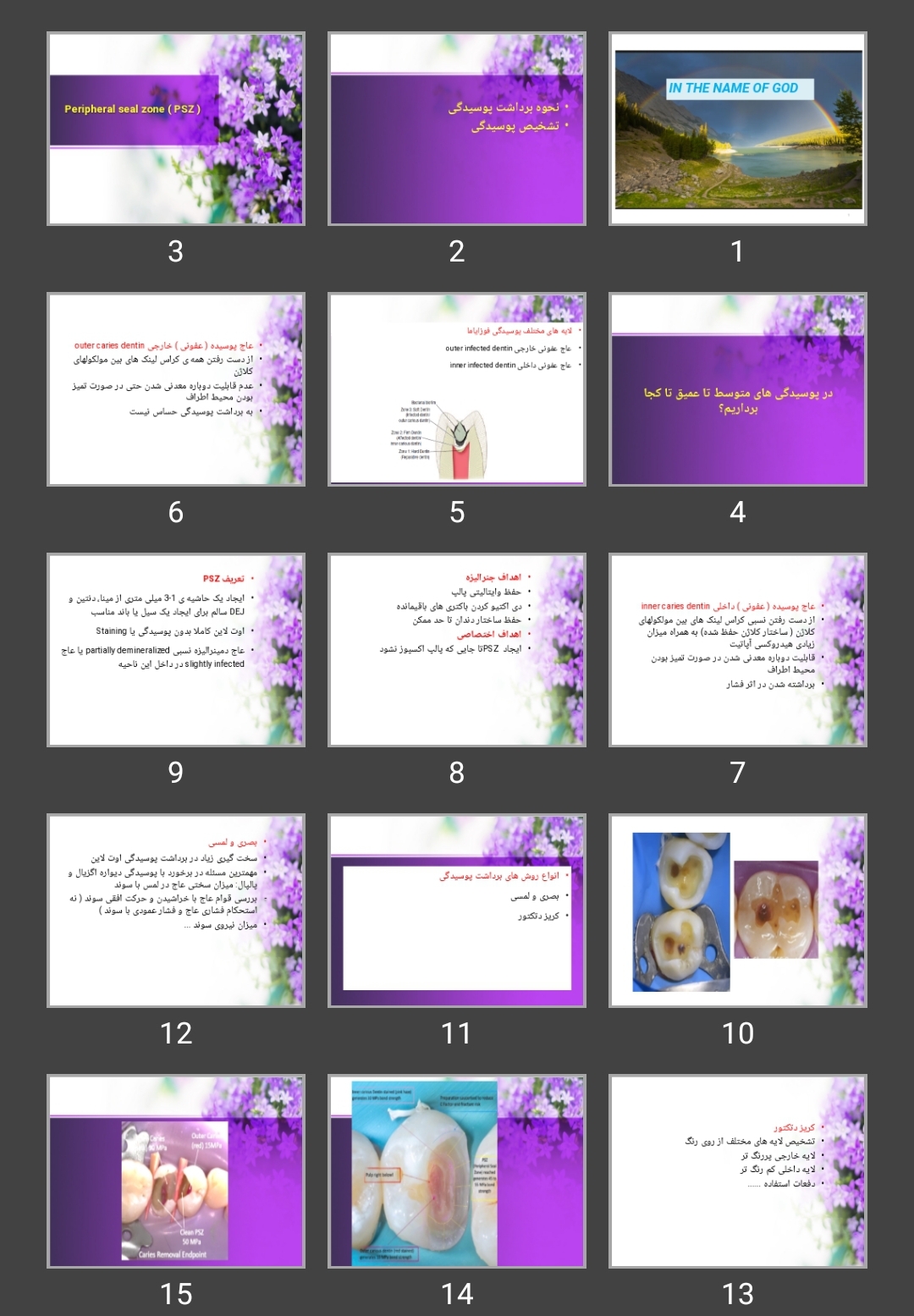پاورپوینت Peripheral seal zone (PSZ)