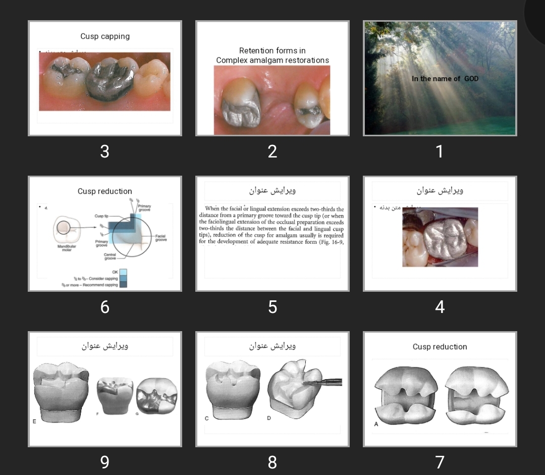 پاورپوینت Retention forms in Complex amalgam restorations