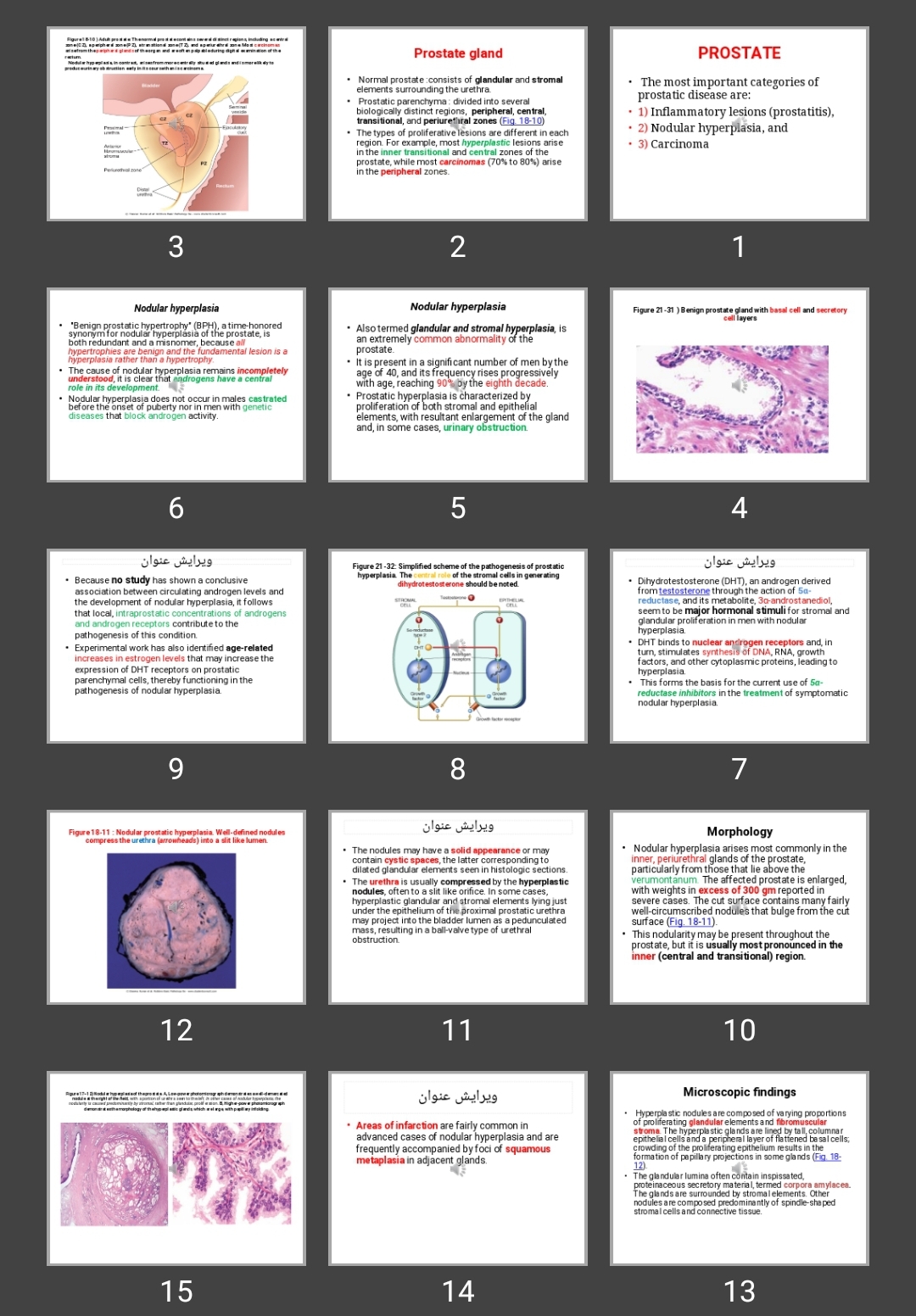 پاورپوینت PROSTATE