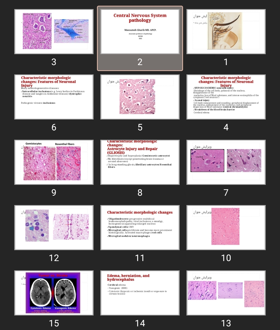 پاورپوینت Central Nervous System pathology