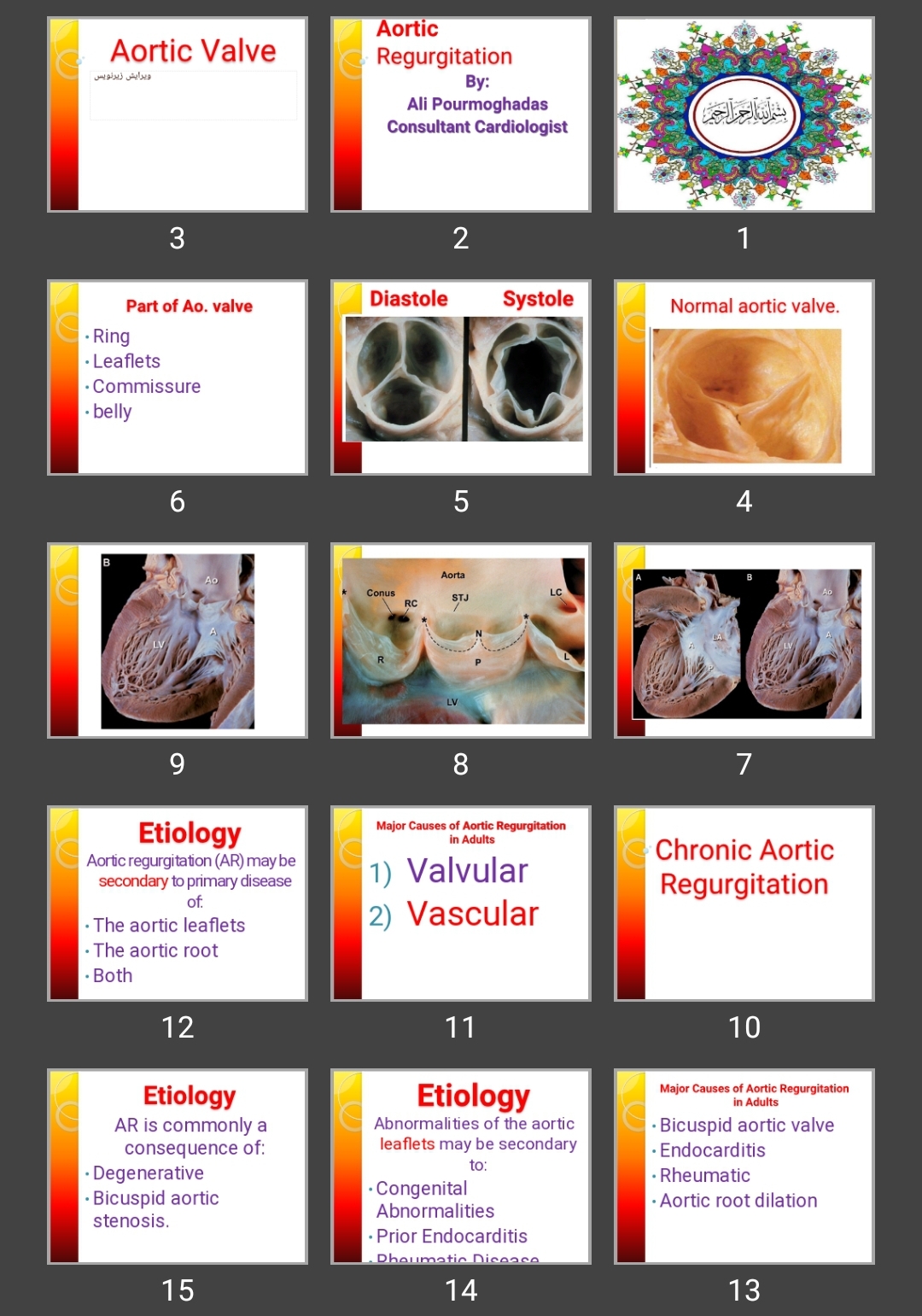 پاورپوینت Aortic Regurgitation