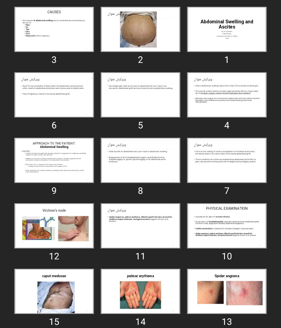 پاورپوینت Abdominal Swelling and Ascites