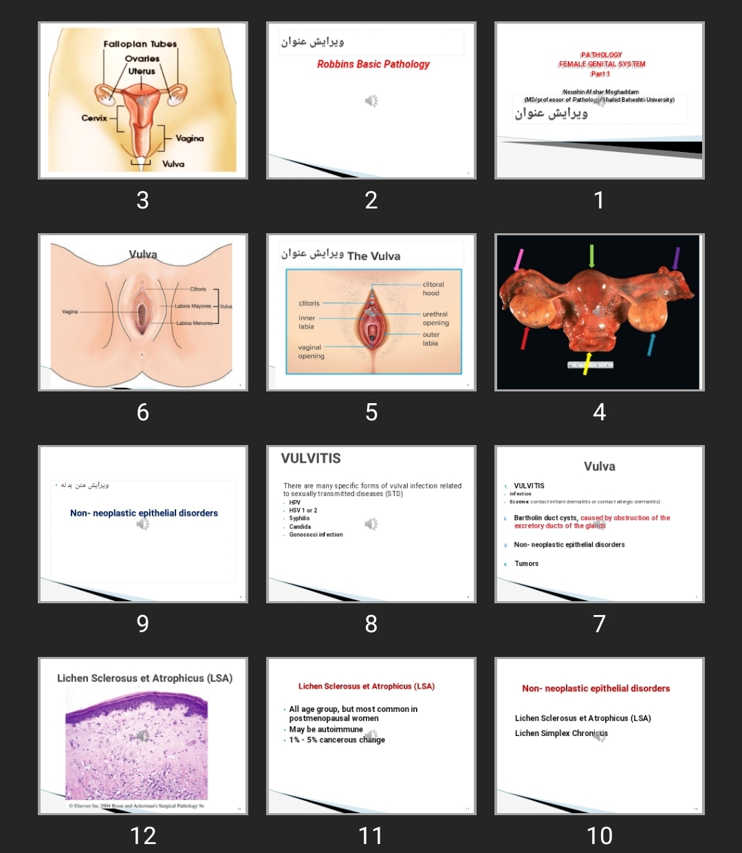 پاورپوینت PATHOLOGY FEMALE GENITAL SYSTEM Part ۱