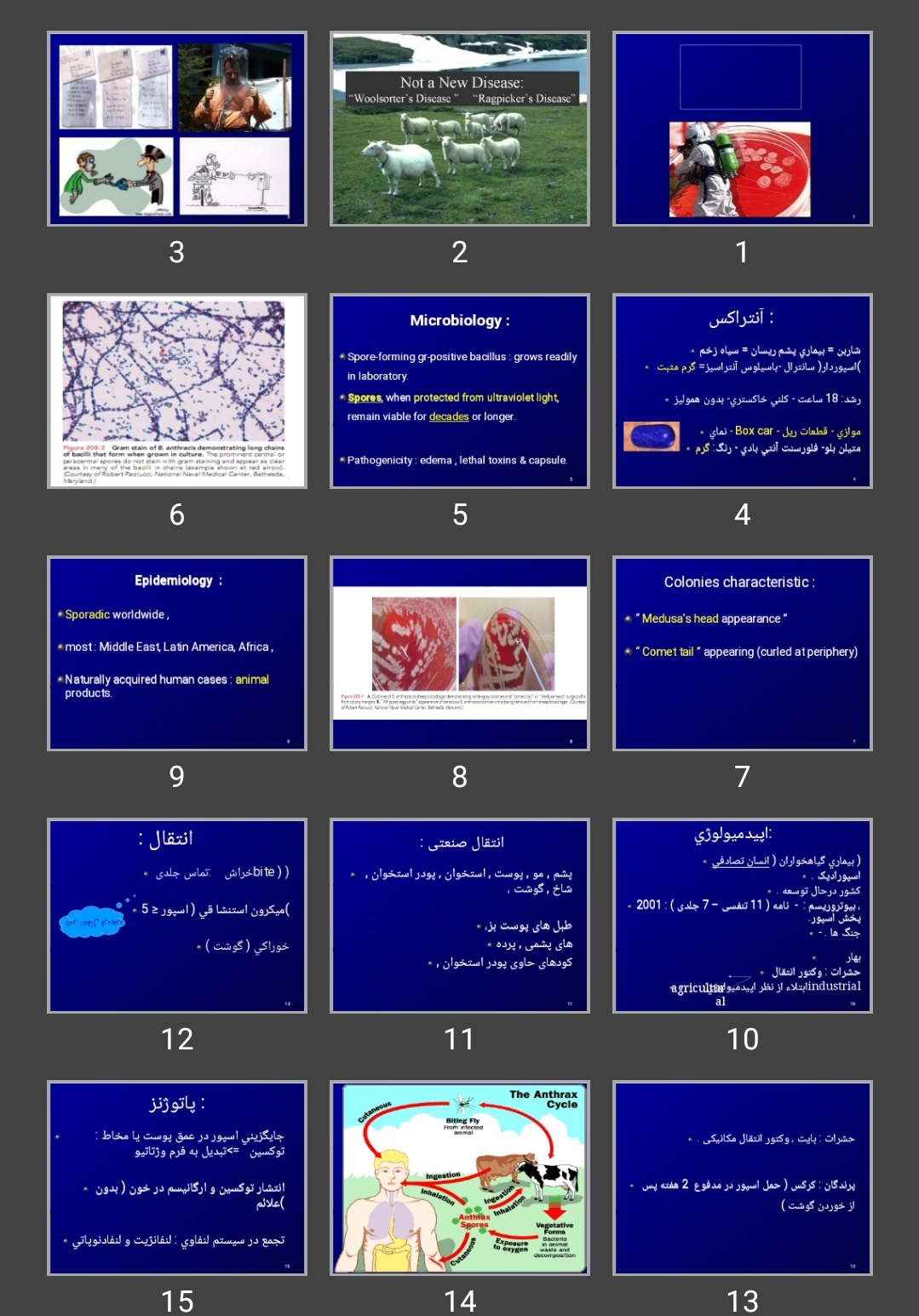 پاورپوینت آنتراكس Anthrax