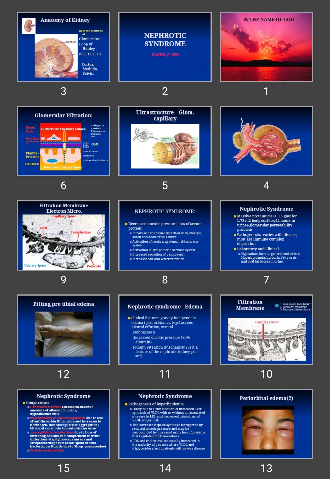 پاورپوینت NEPHROTIC SYNDROME