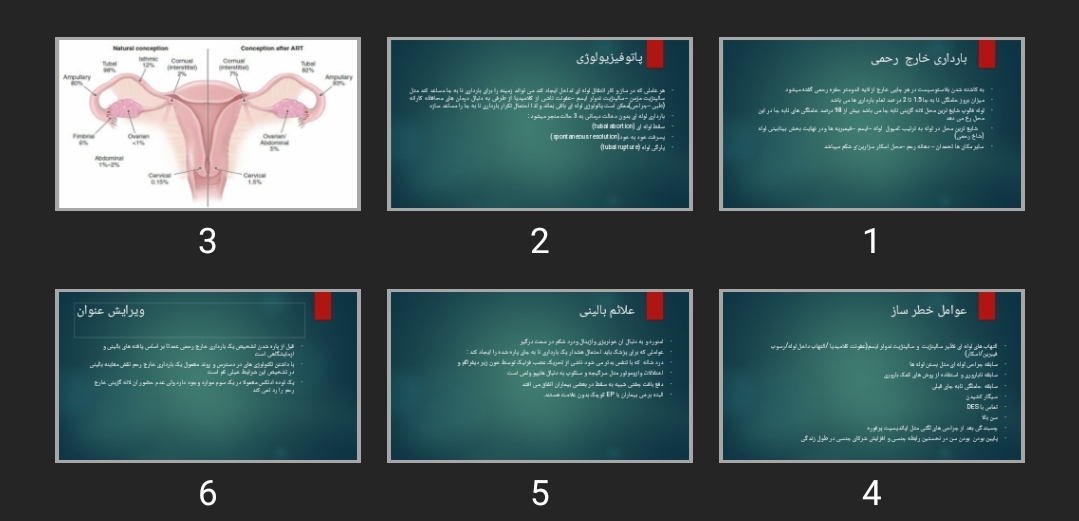 پاورپوینت بارداری خارج رحمی