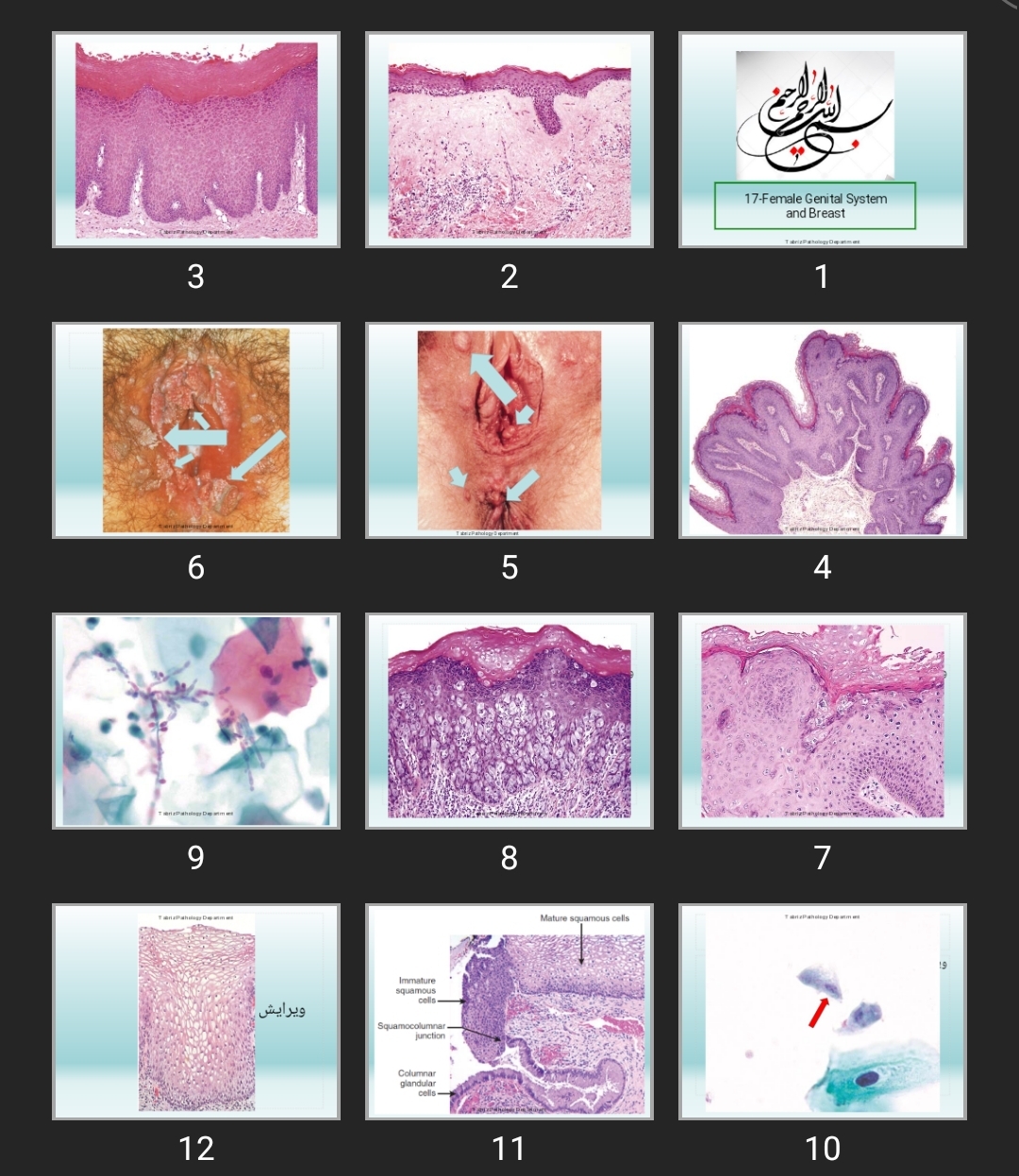 پاورپوینت  17-Female Genital System and Breast