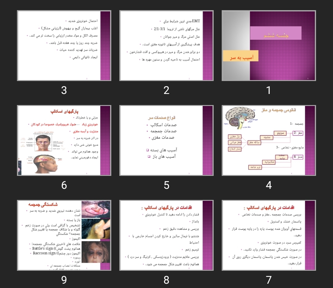 پاورپوینت آسيب به سر