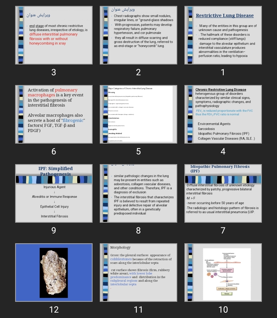 پاورپوینت Pulmonary PathologyRestrictive Lung Disease