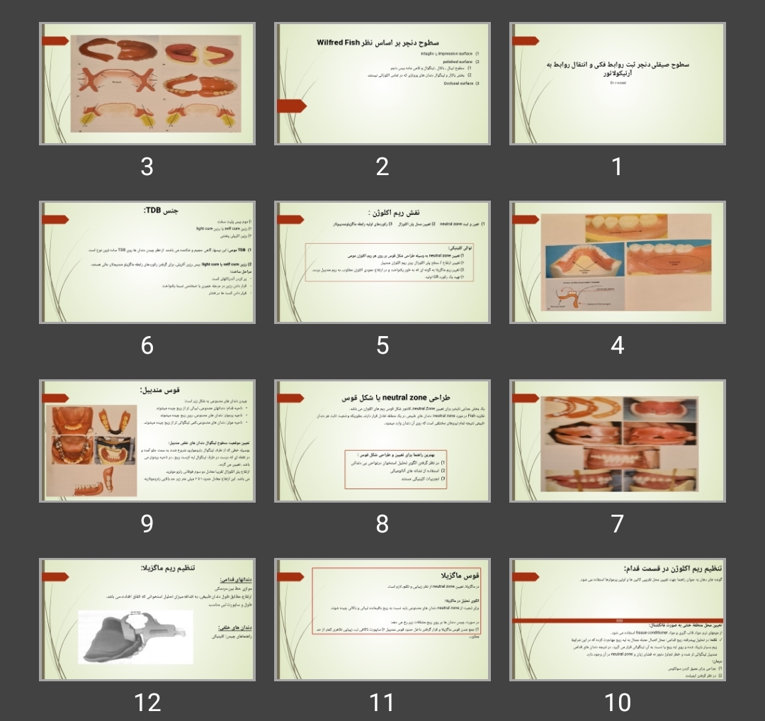 پاورپوینت سطوح صیقلی دنچر ثبت روابط فکی و انتقال روابط به آرتیکولاتور