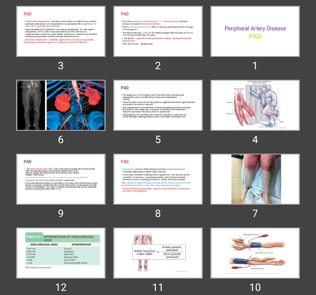 پاورپوینت Peripheral Artery Disease PAD
