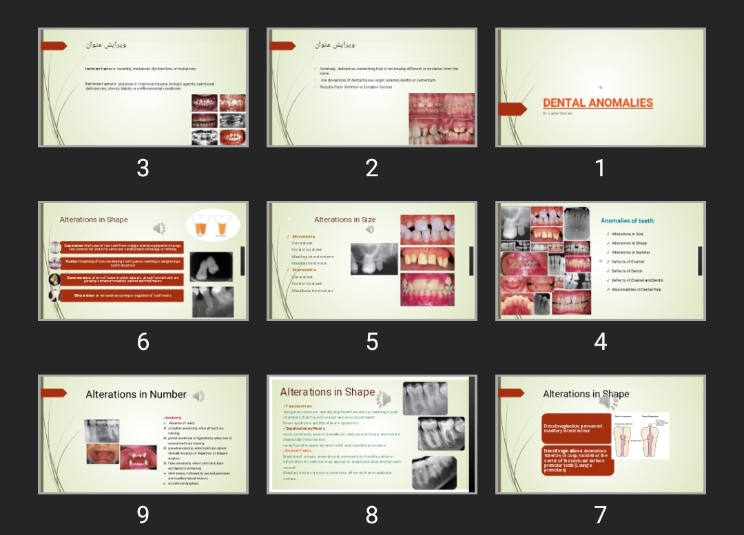 پاورپوینت DENTAL ANOMALIES