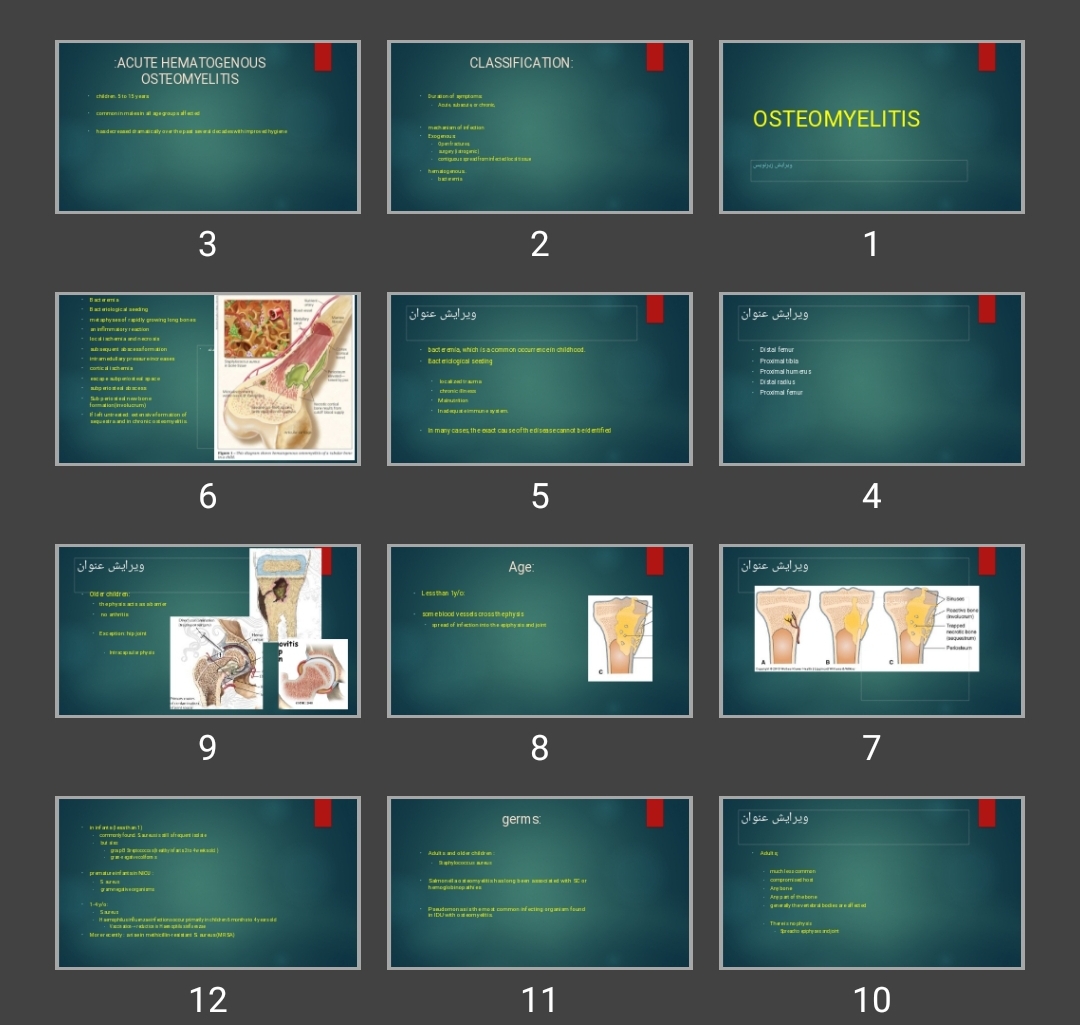 پاورپوینت استئومیلیت OSTEOMYELITIS