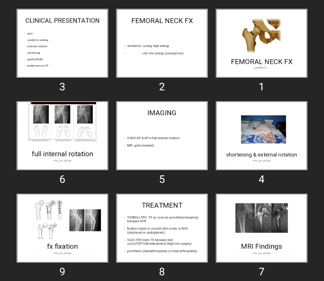 پاورپوینت FEMORAL NECK FX