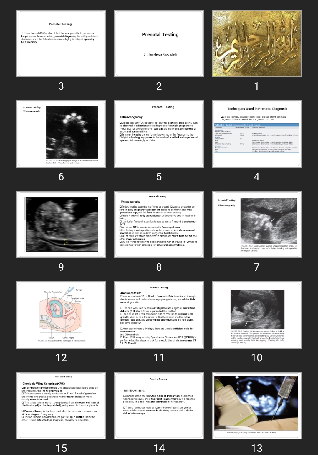 پاورپوینت Prenatal Testing