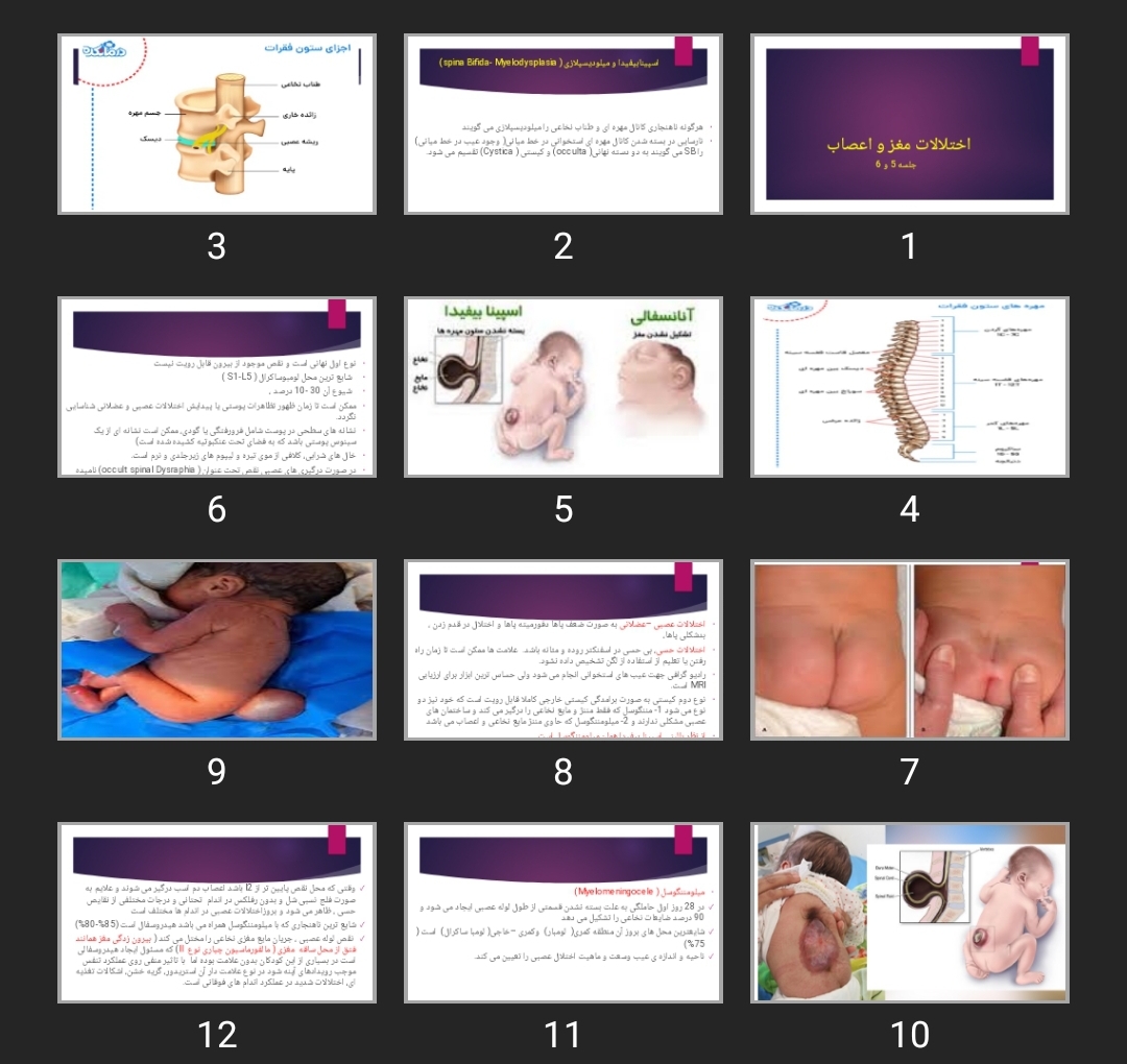 پاورپوینت اختلالات مغز و اعصاب