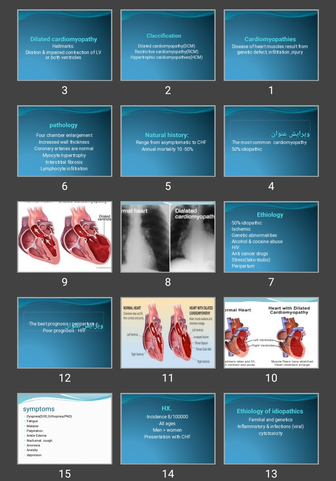 پاورپوینت Cardiomyopathies