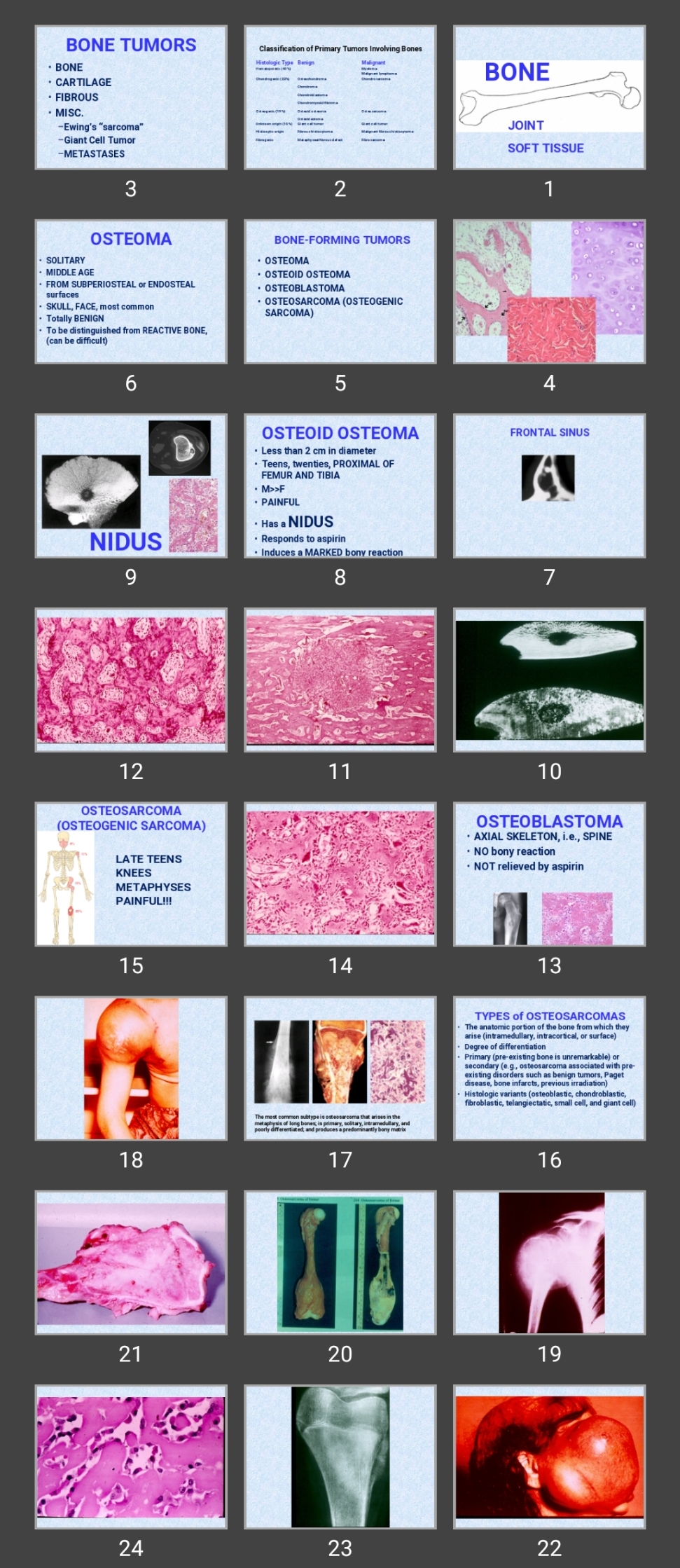 پاورپوینت BONE TUMORS