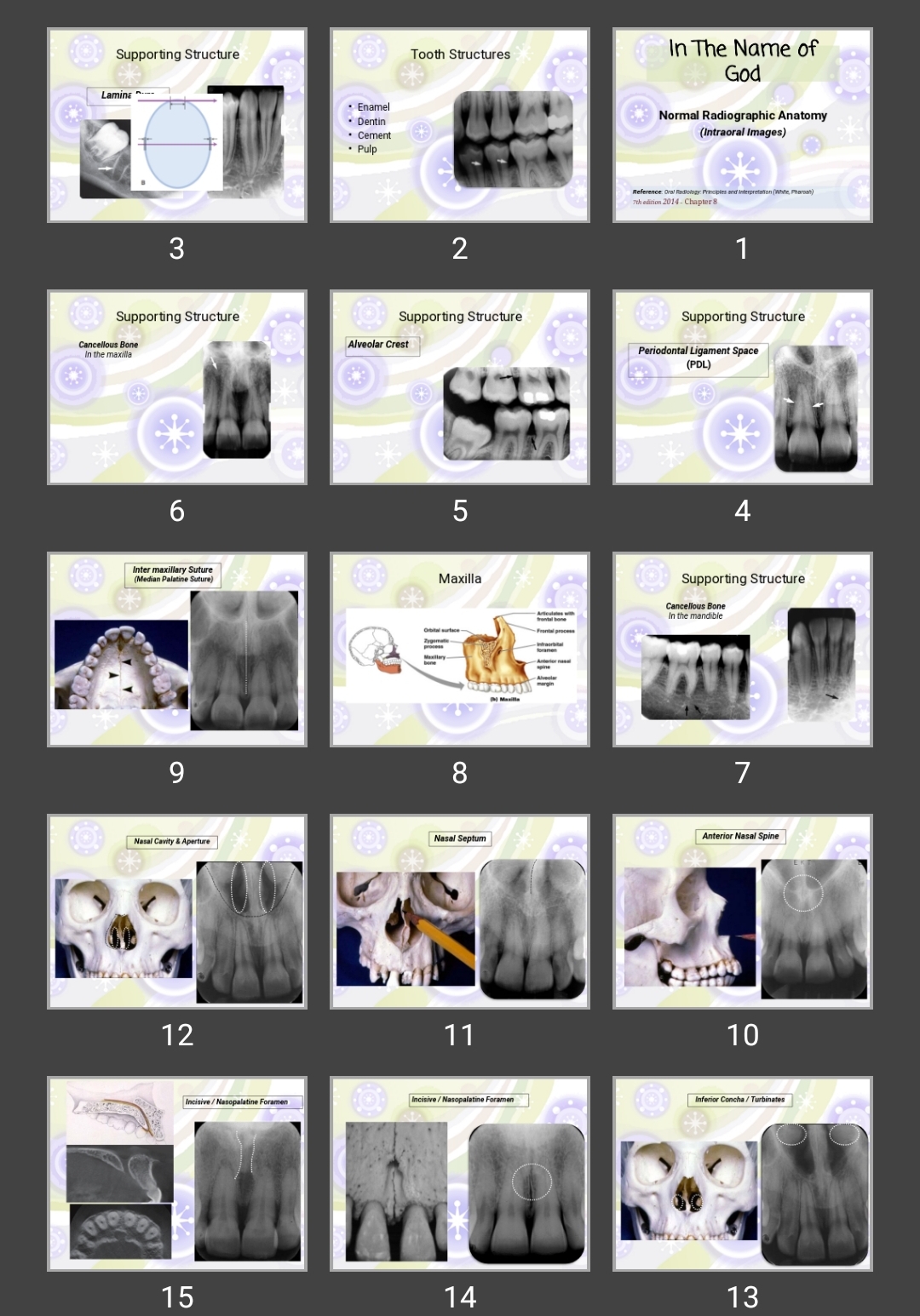 پاورپوینت Normal Radiographic Anatomy (Intraoral Images)