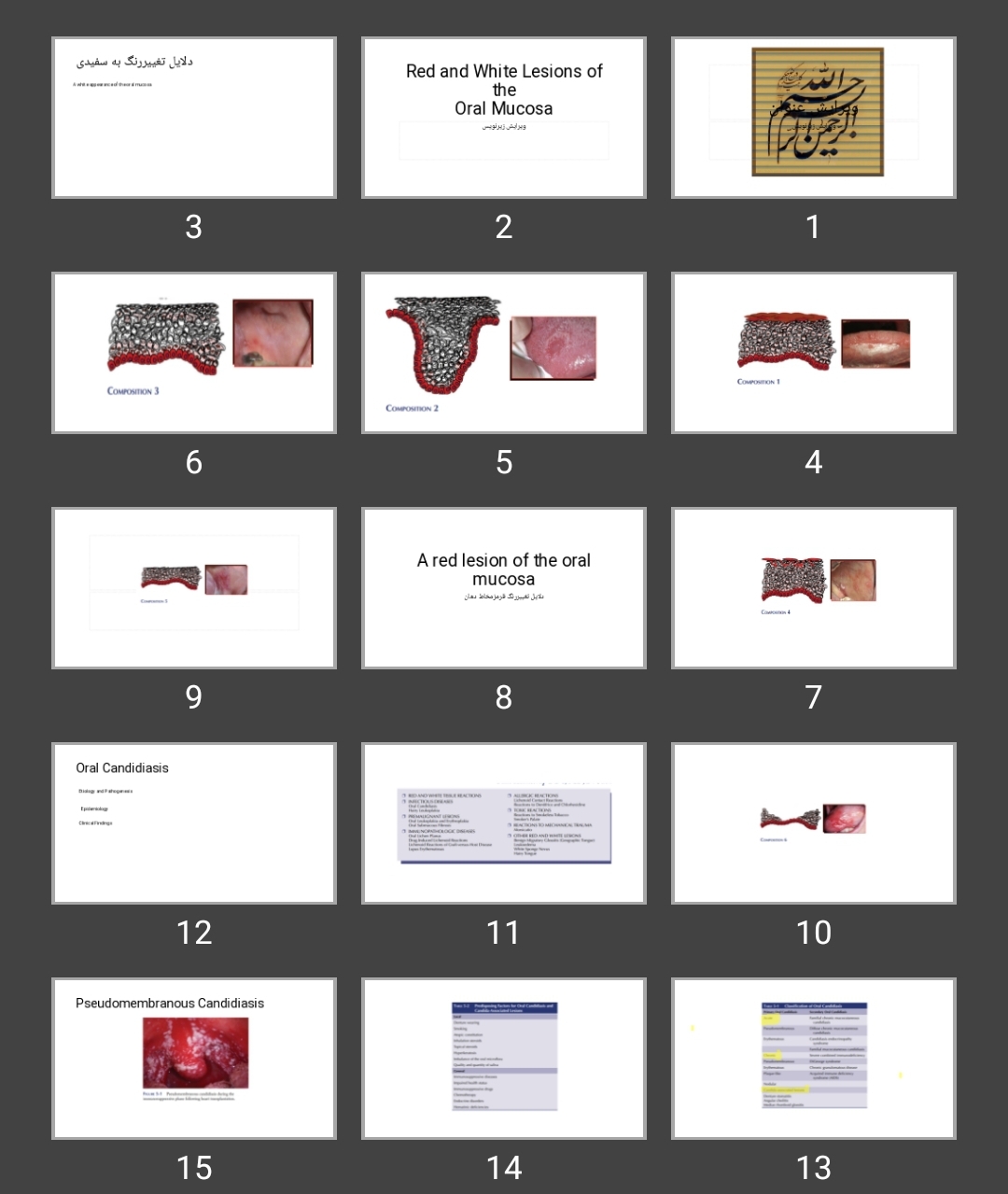 پاورپوینت Red and White Lesions of the  Oral Mucosa