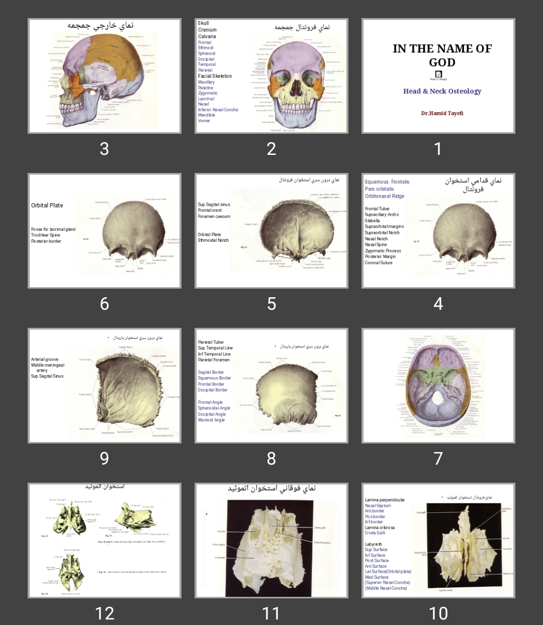 پاورپوینت Head & Neck Osteology