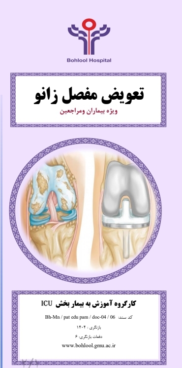 پمفلت تعویض مفصل زانو