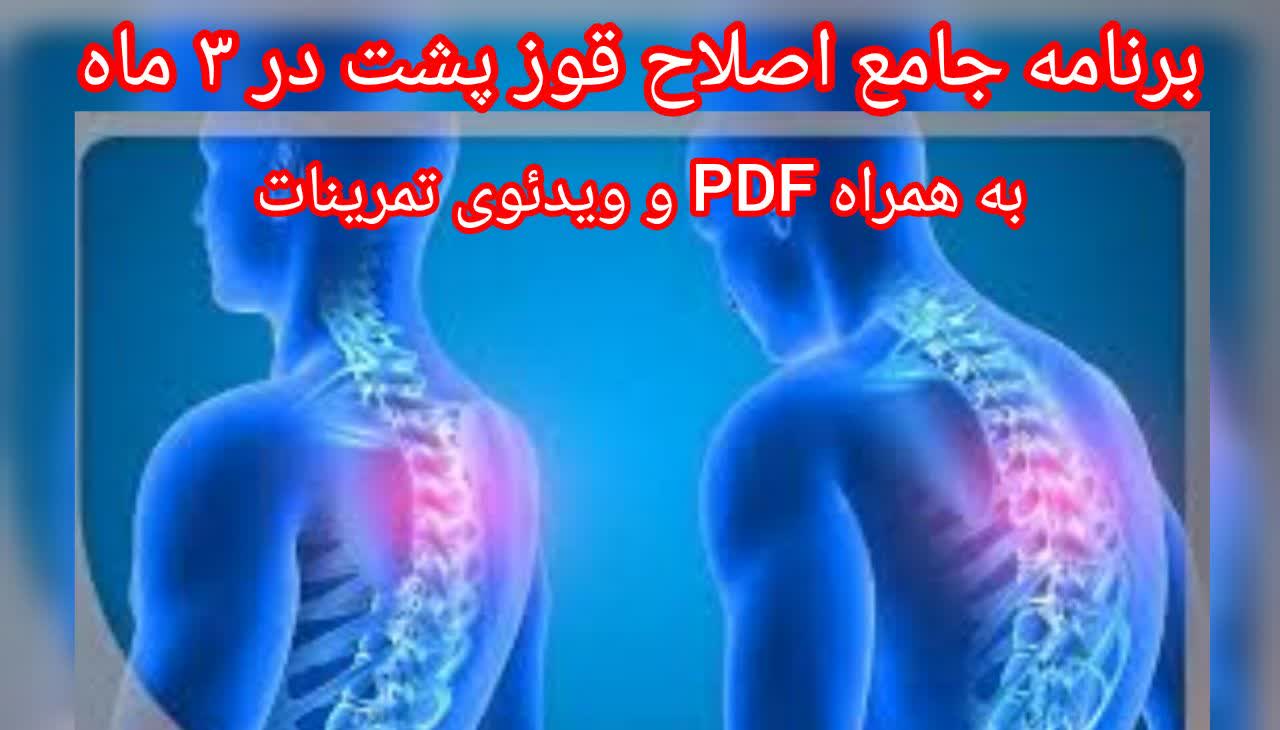 بسته جامع اصلاح قوز پشت در ۳ ماه