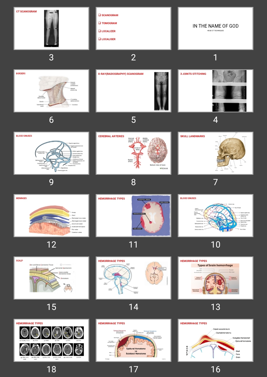 پاورپوینت HEAD CT TECHNIQUES