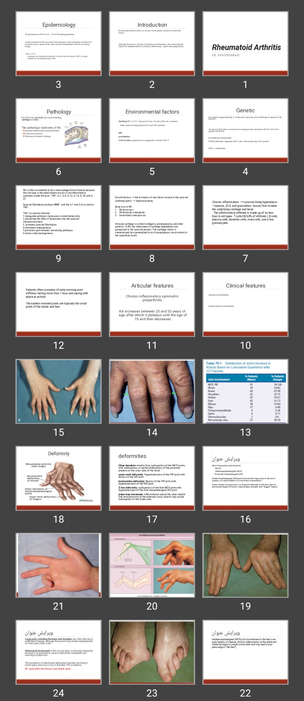 پاورپوینت Rheumatoid Arthritis