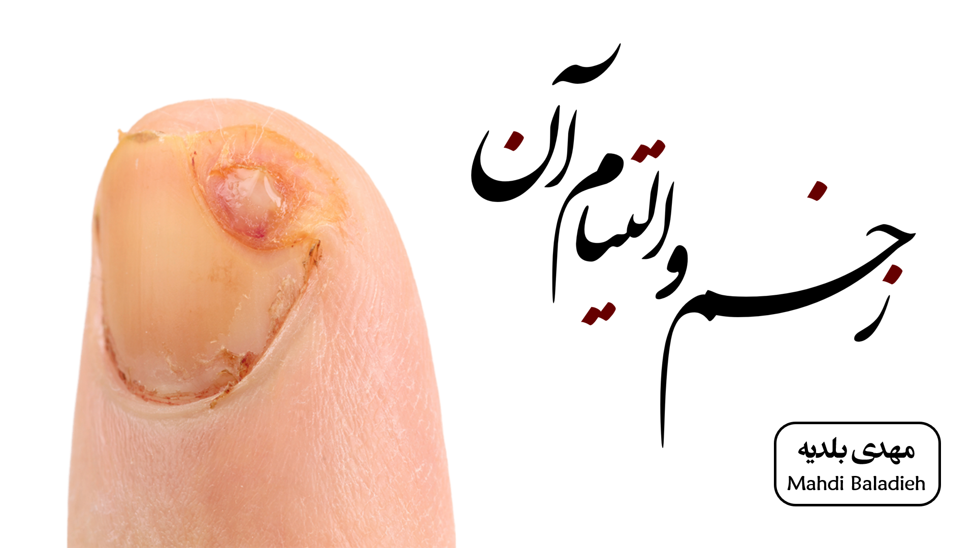 پاورپوینت فصل ترمیم زخم لارنس ۲۰۱۹+ شوارتز ۲۰۱۹