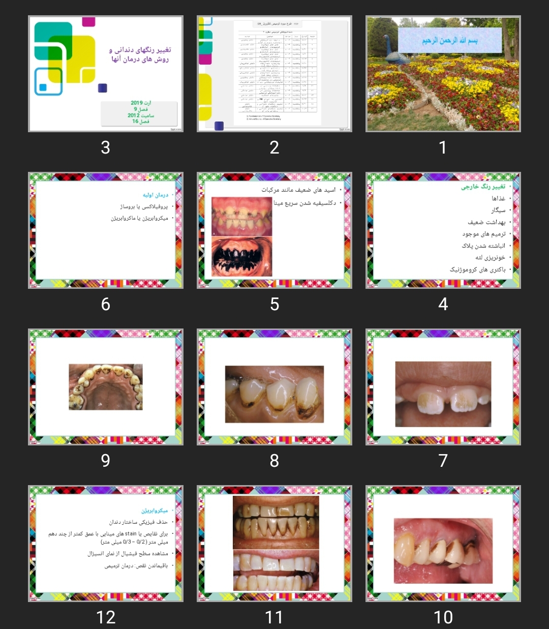 پاورپوینت تغییر رنگ های دندانی و روش های درمان آنها