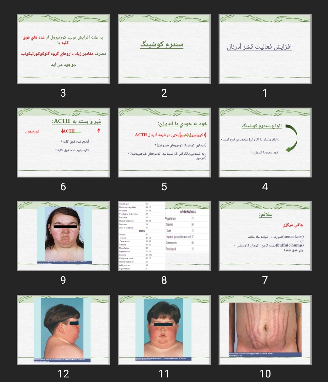 پاورپوینت سندرم كوشينگ