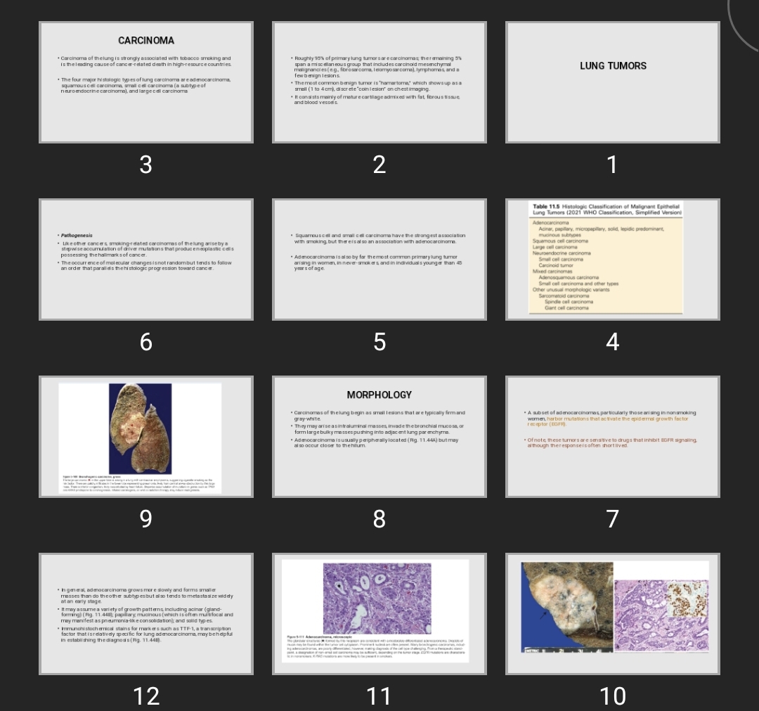 پاورپوینت Lung tumor