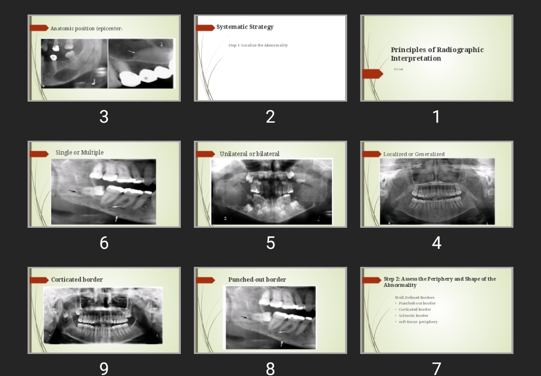 پاورپوینت Principles of Radiographic Interpretation