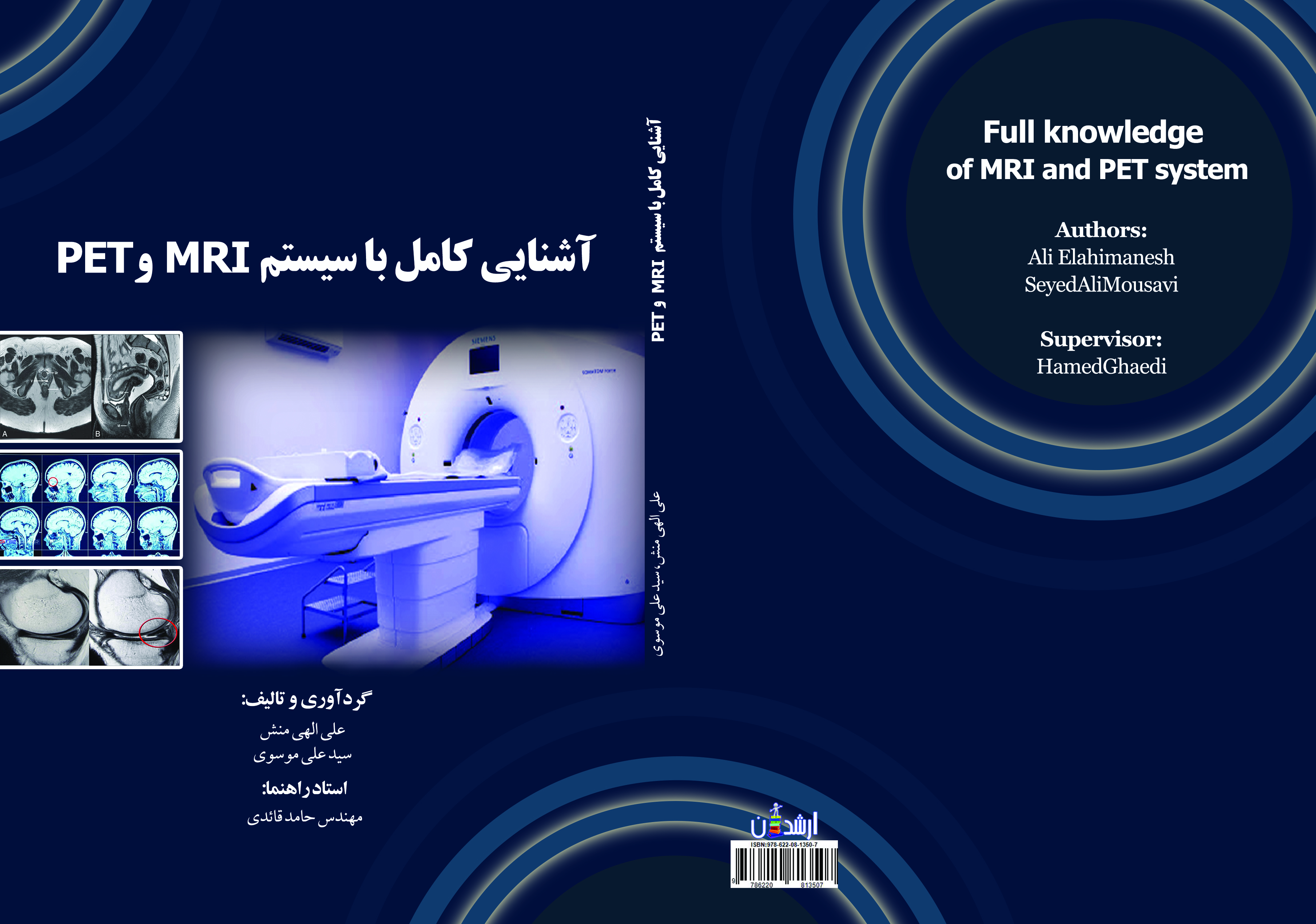 آشنایی کامل با سیستم MRI و PET
