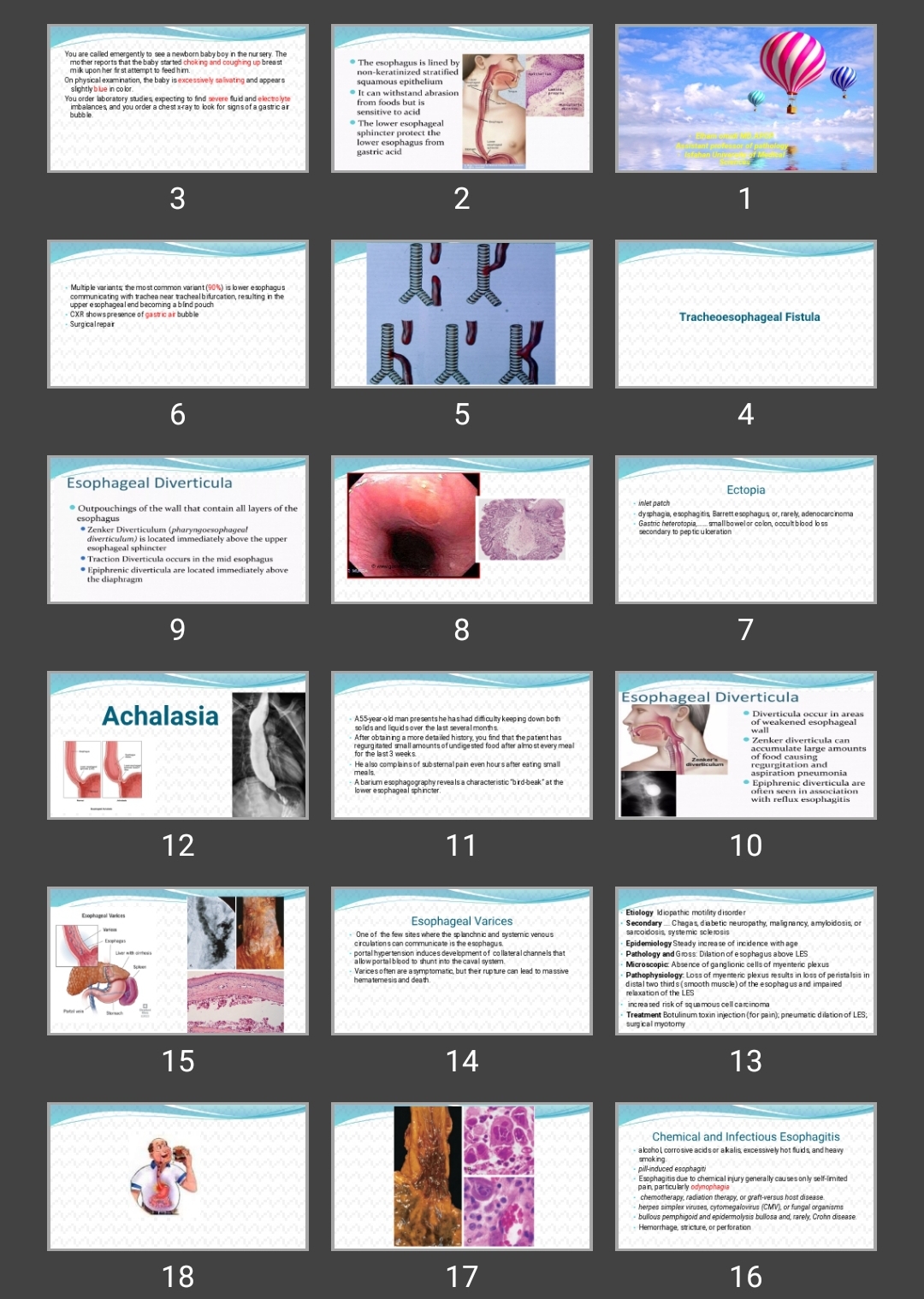 پاورپوینت Esophagus