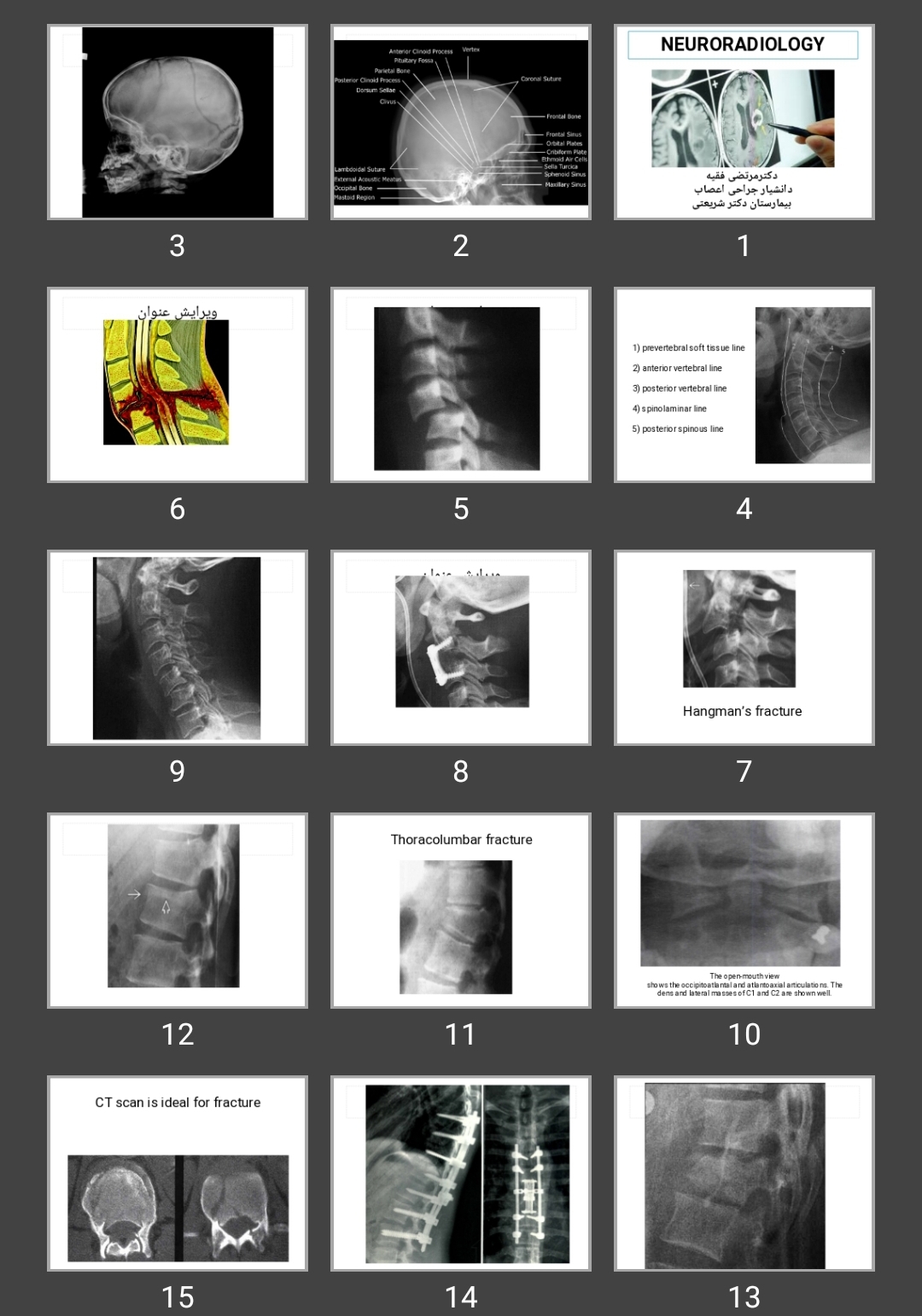 پاورپوینت نورورادیولوژی NEURORADIOLOGY