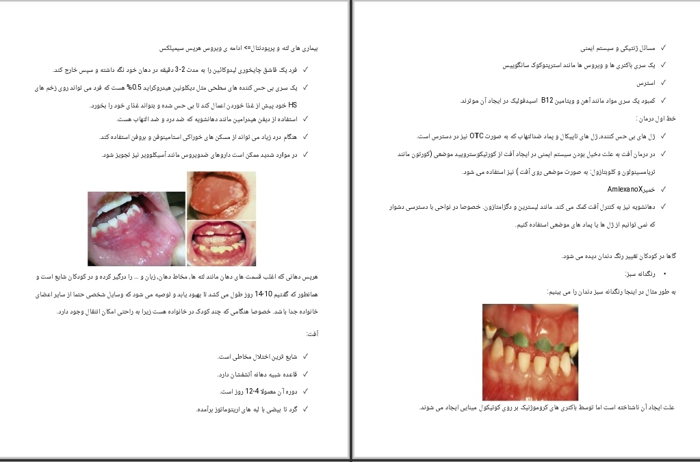 جزوه بیماری های لثه و پریودنتال (ویروس هرپس سیمپلکس)