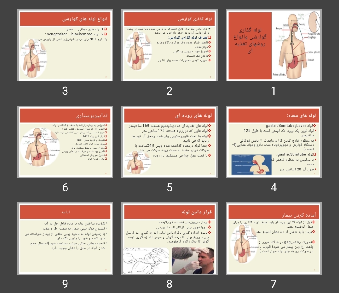 پاورپوینت لوله گذاری گوارشی وانواع روش های تغذیه ای