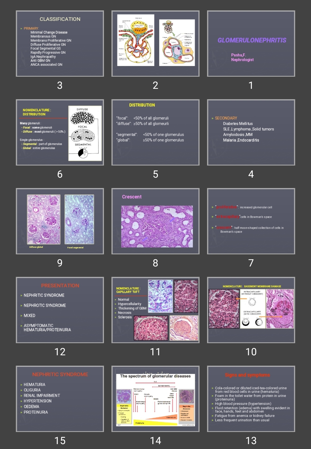 پاورپوینت GLOMERULONEPHRITIS